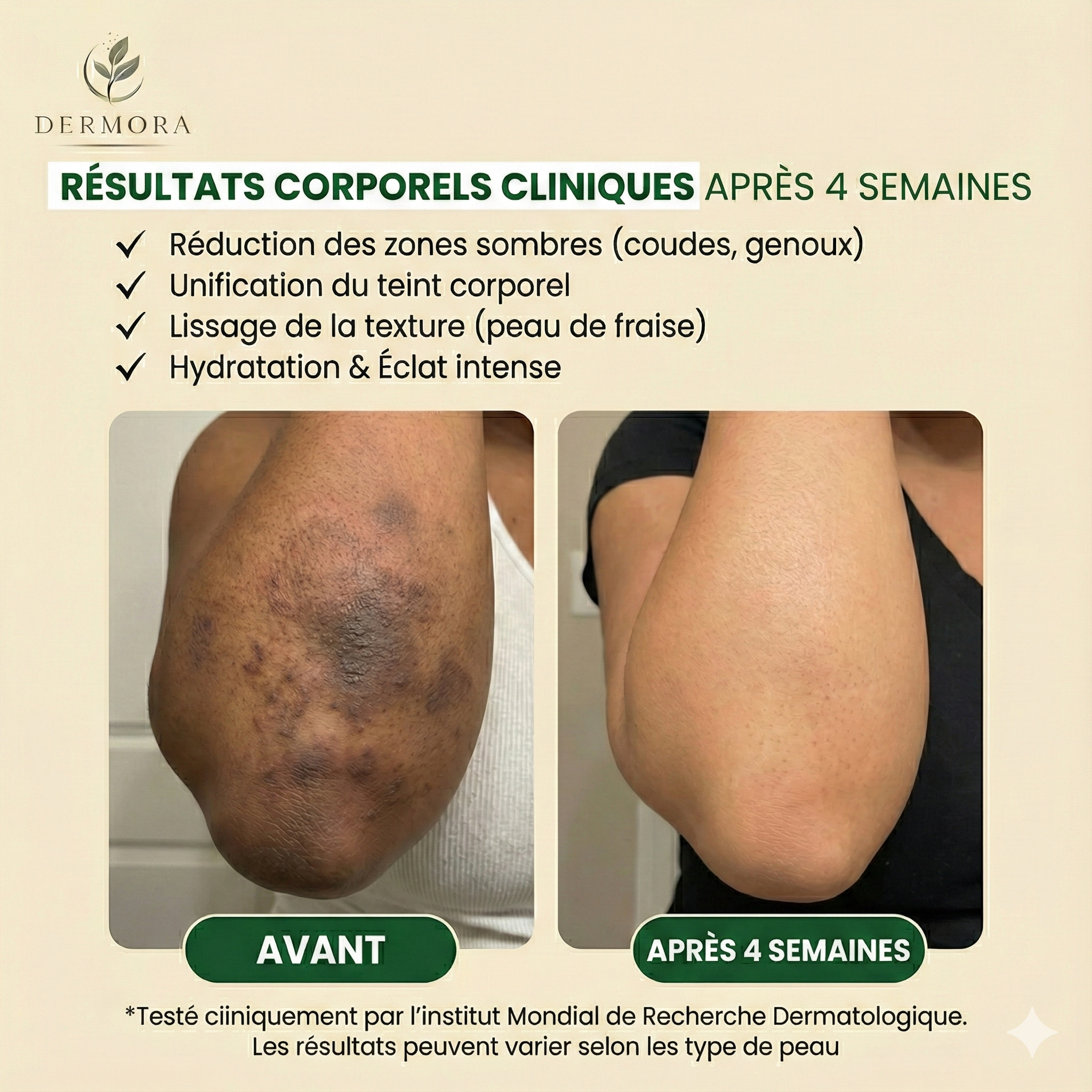 Savon Corps Anti-Taches & Glow (Curcuma + Kojic)